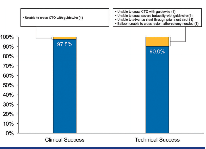 FIGURE 2. Procedural success and reasons for failure. Clinical and technical success rates of robotic percutaneous coronary intervention with the CorPath GRX system. Reasons for clinical or technical failure are listed in the adjacent boxes, with the sin - gle clinical failure being a chronic total occlusion (CTO) requiring subsequent antegrade wire escalation approach at a future date. That failure is also listed as 1 of the 4 cases of technical failure.