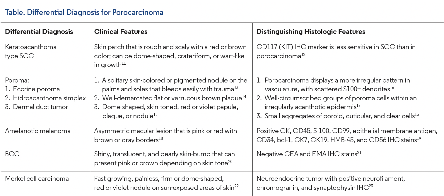 Table. Differential Diagnosis for Porocarcinoma