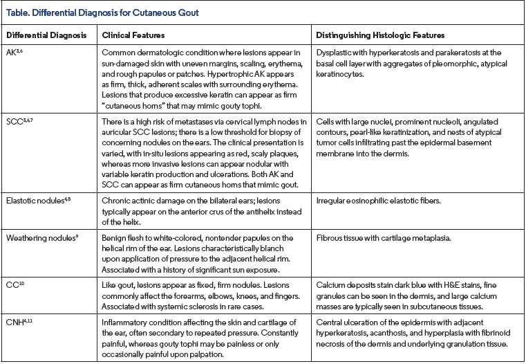 table differential diagnosis