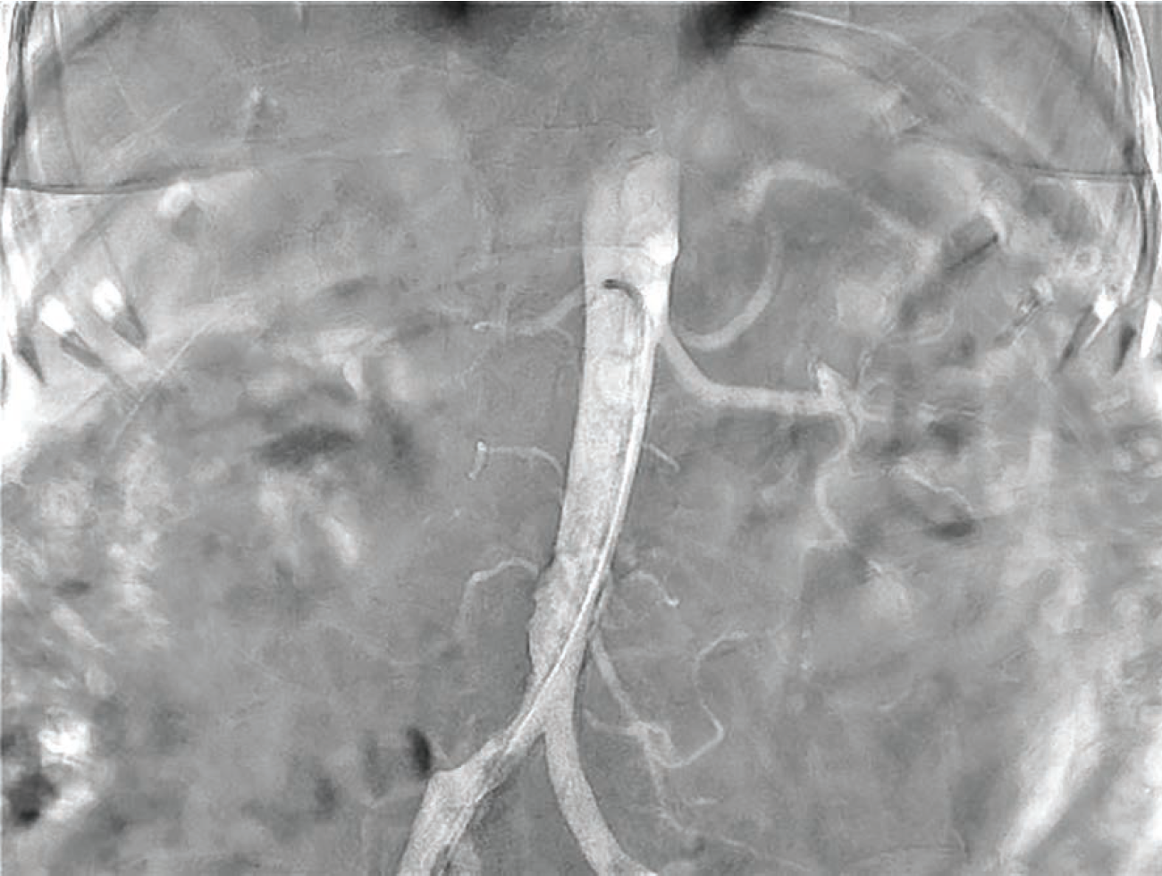Secemsky Fig 1 May 2024