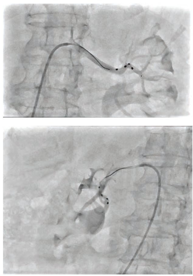 Secemsky Videos 1-2  May 2024