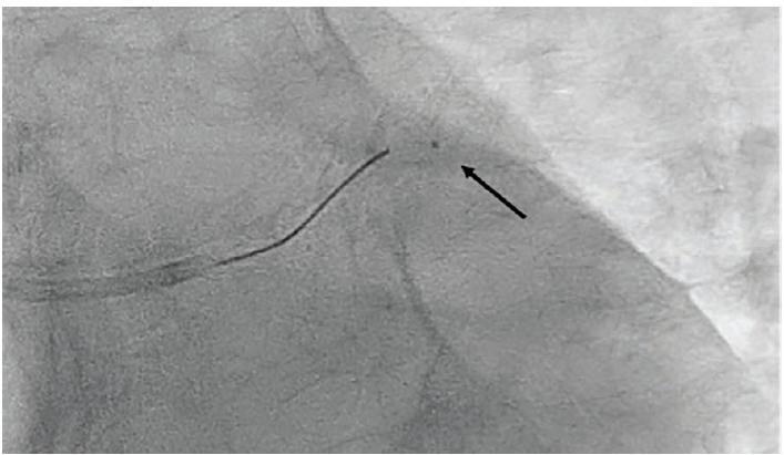Sengodan - Fig 2 - October 2024