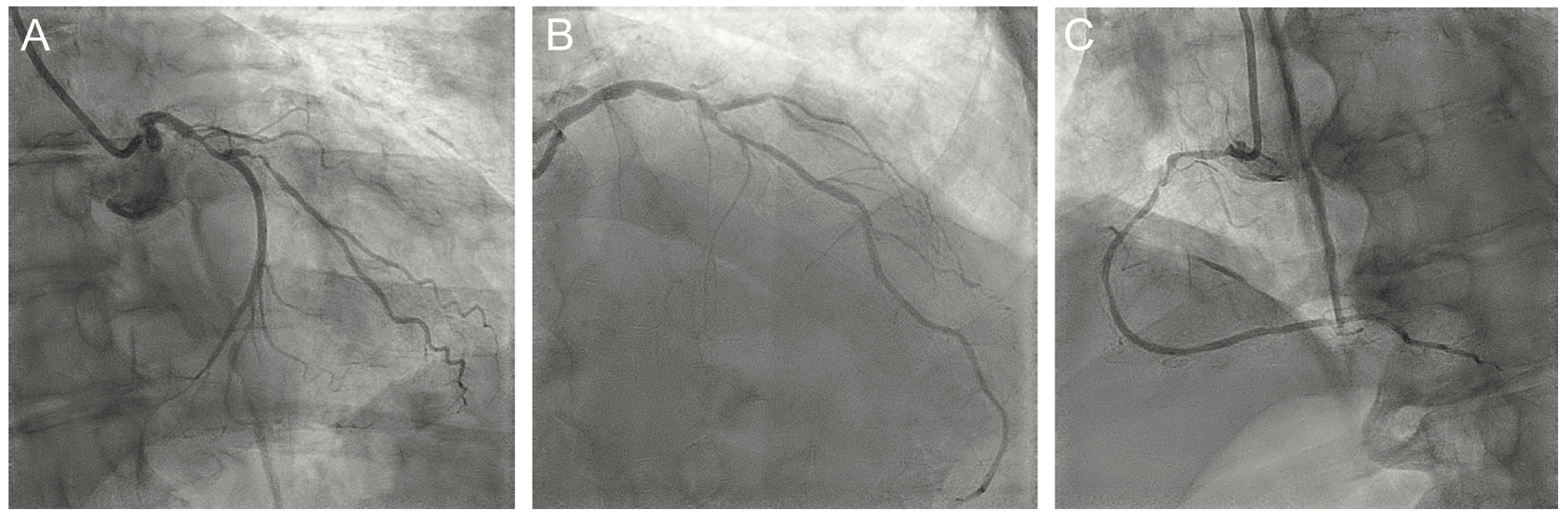 Shah Balloon Uncrossable Figure 1
