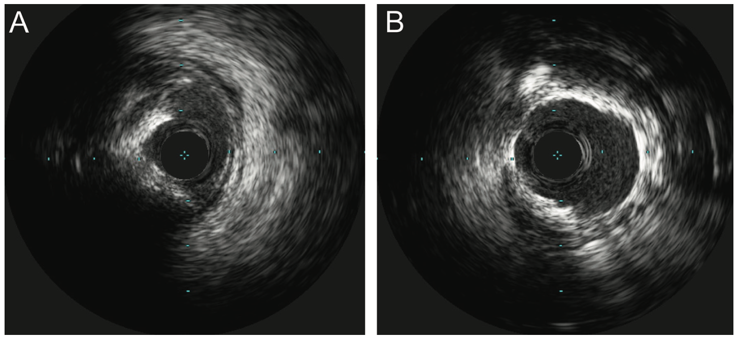 Shah Balloon Uncrossable Figure 3