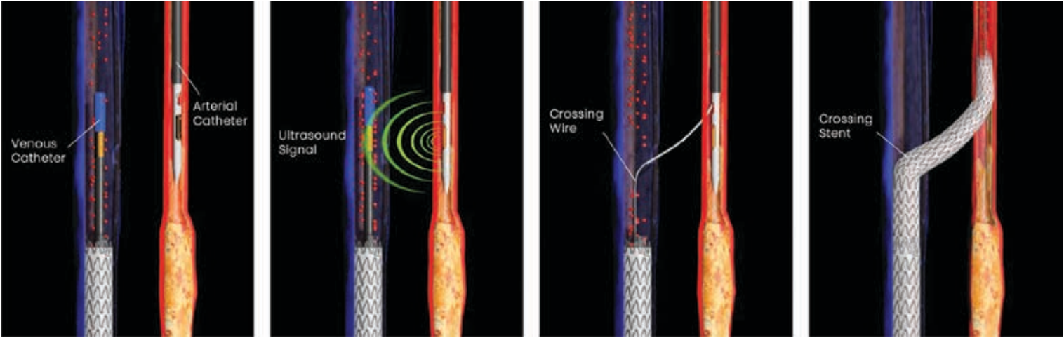 Shishehbor- Fig2-CLD-June 2025.png 