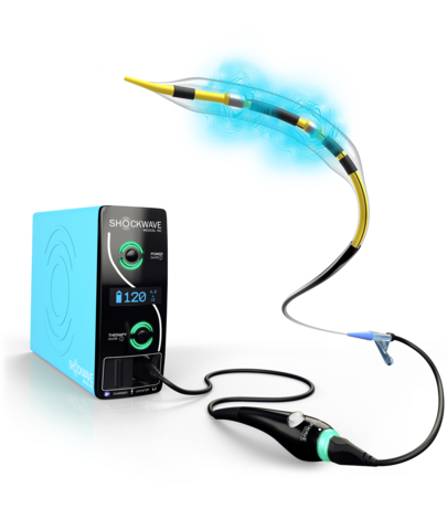 Shockwave C2 Aero, a next generation coronary intravascular lithotripsy (IVL) catheter that resets physicians’ expectations by addressing unmet needs in deliverability, lesion crossing and balloon repositioning.