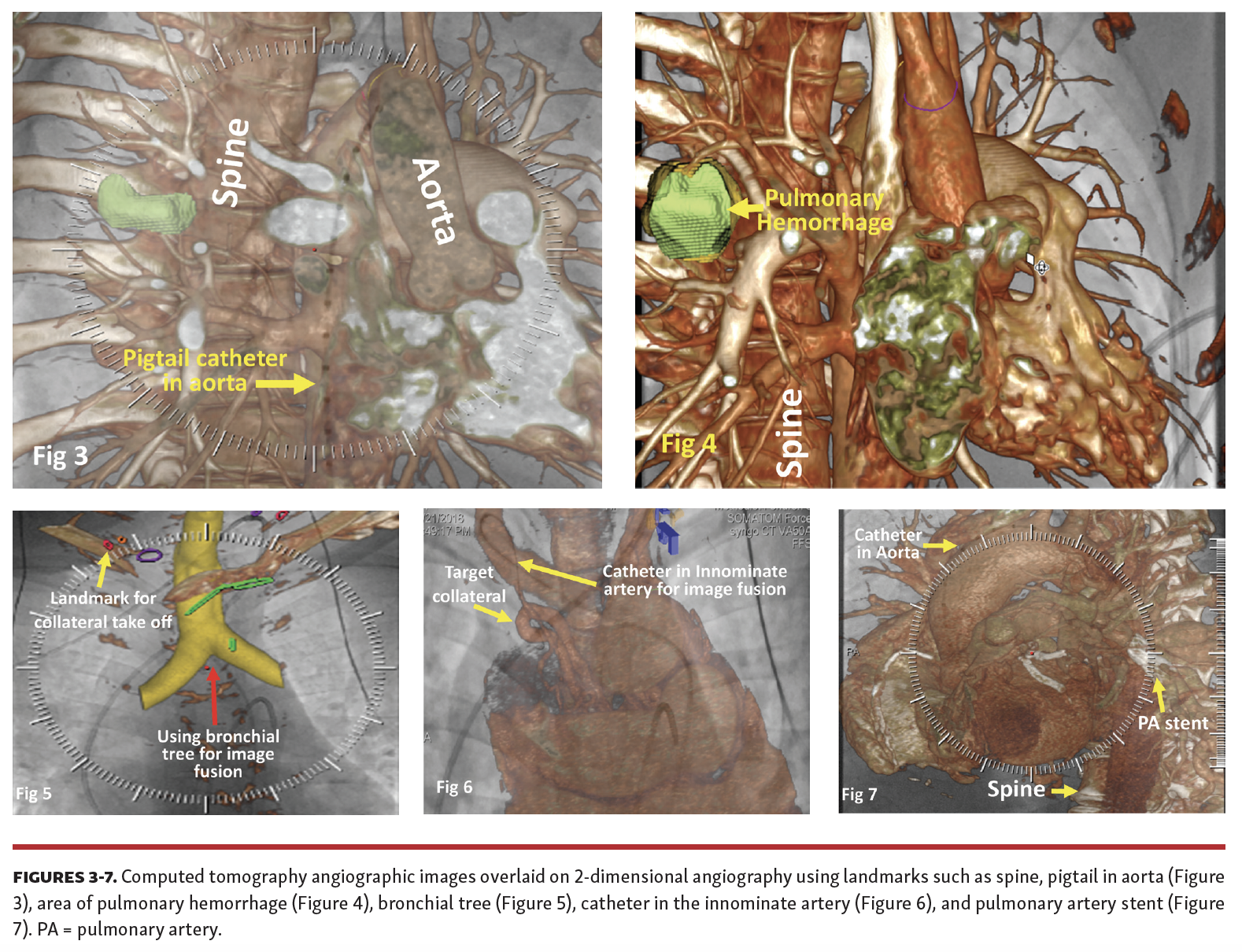 Singh CT-Fluoro Fig 3-7