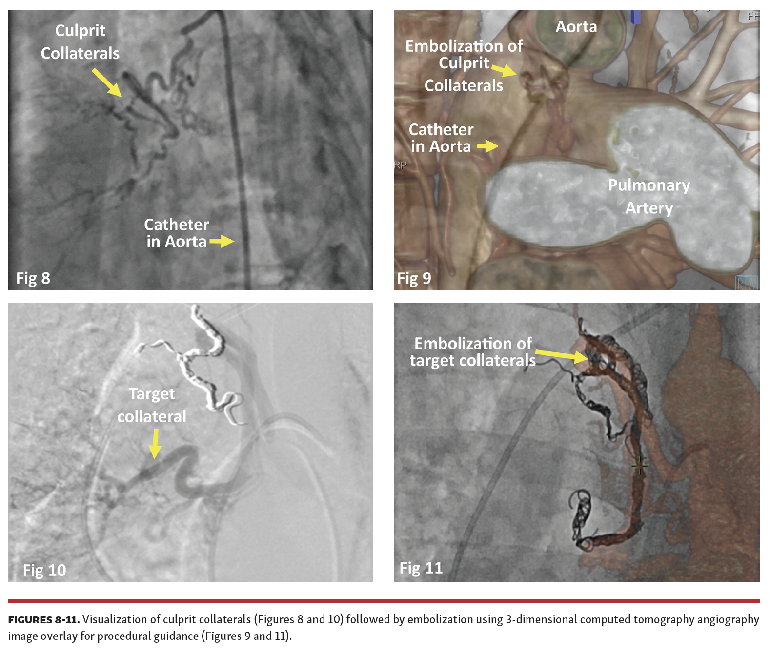 Singh CT-Fluoro Fig 8-11