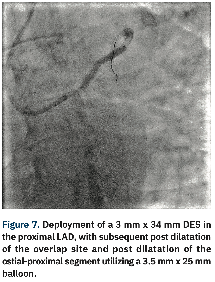 Sizemore Calcified Lesions Figure 7