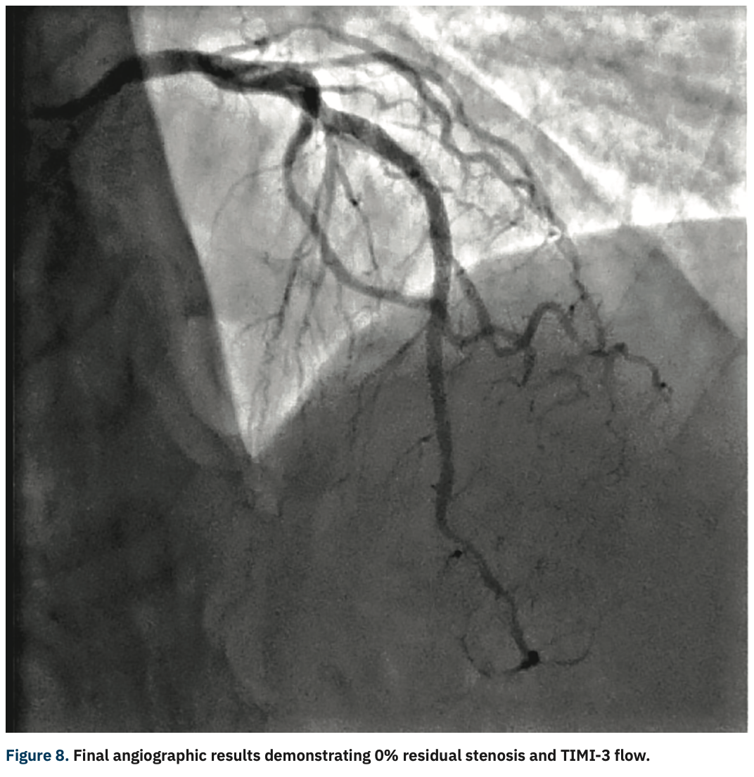 Sizemore Calcified Lesions Figure 8