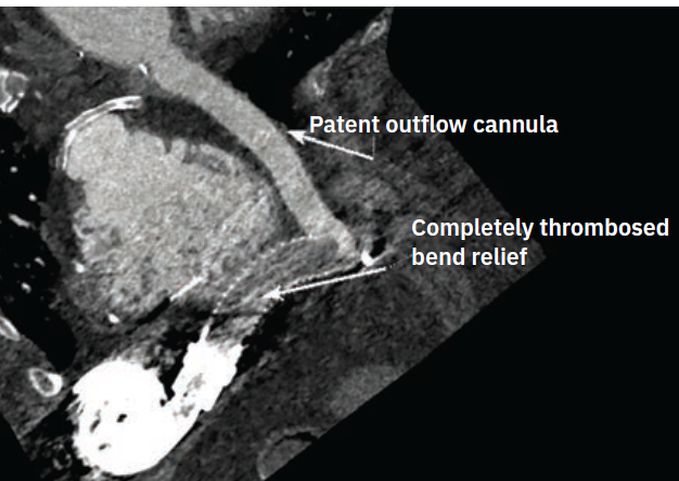 Smith Fig 1 May 2024
