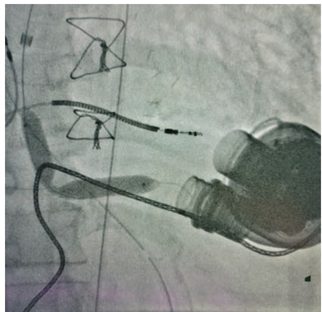 Smith Fig 2 May 2024