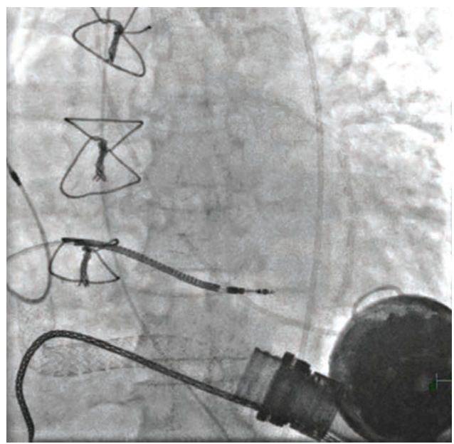 Smith Fig 3 May 2024