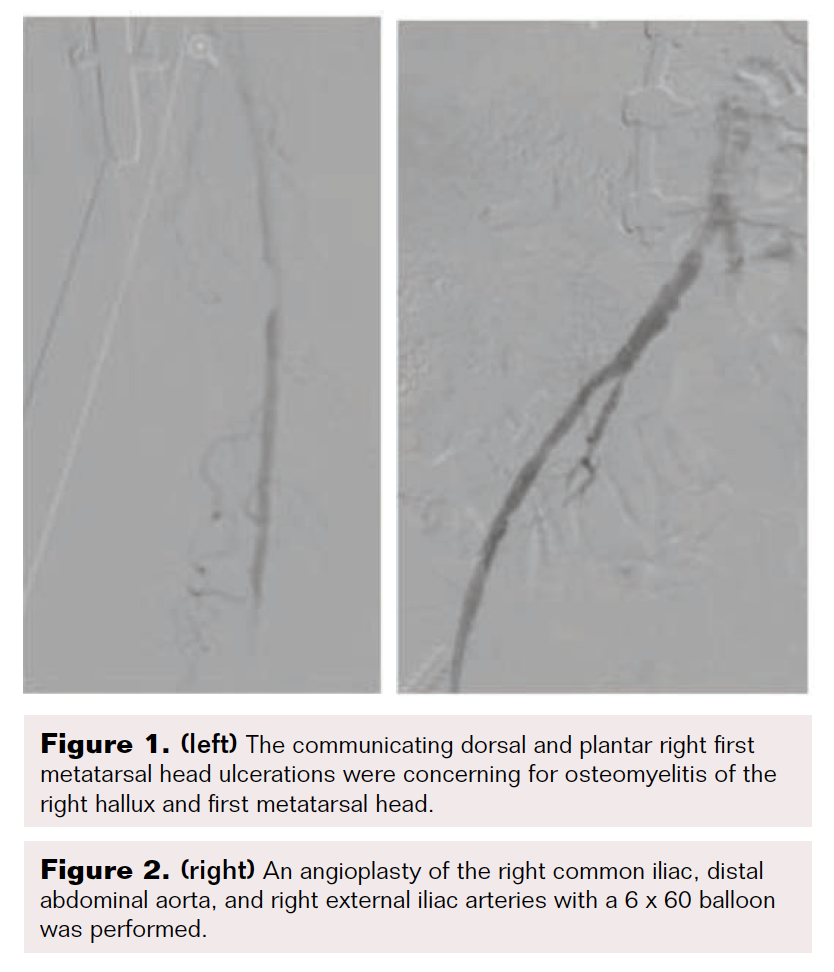 Figure 1 and Figure 2