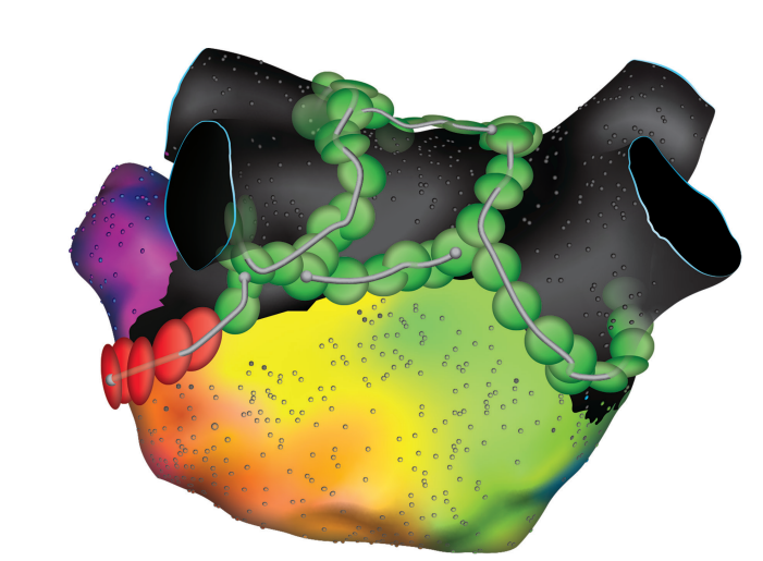 Sundaram-Fig2-EPLD-April 2026.png 