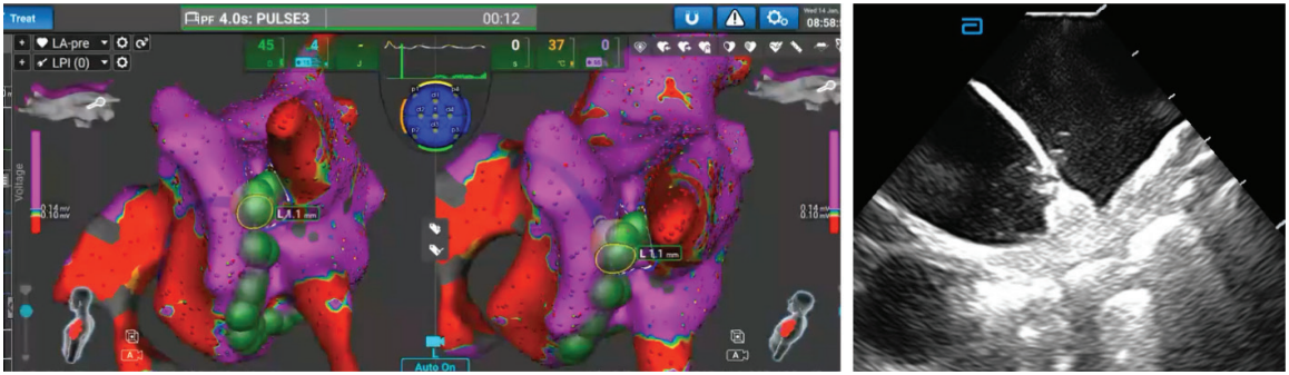 Sundaram-Fig3-EPLD-April 2026