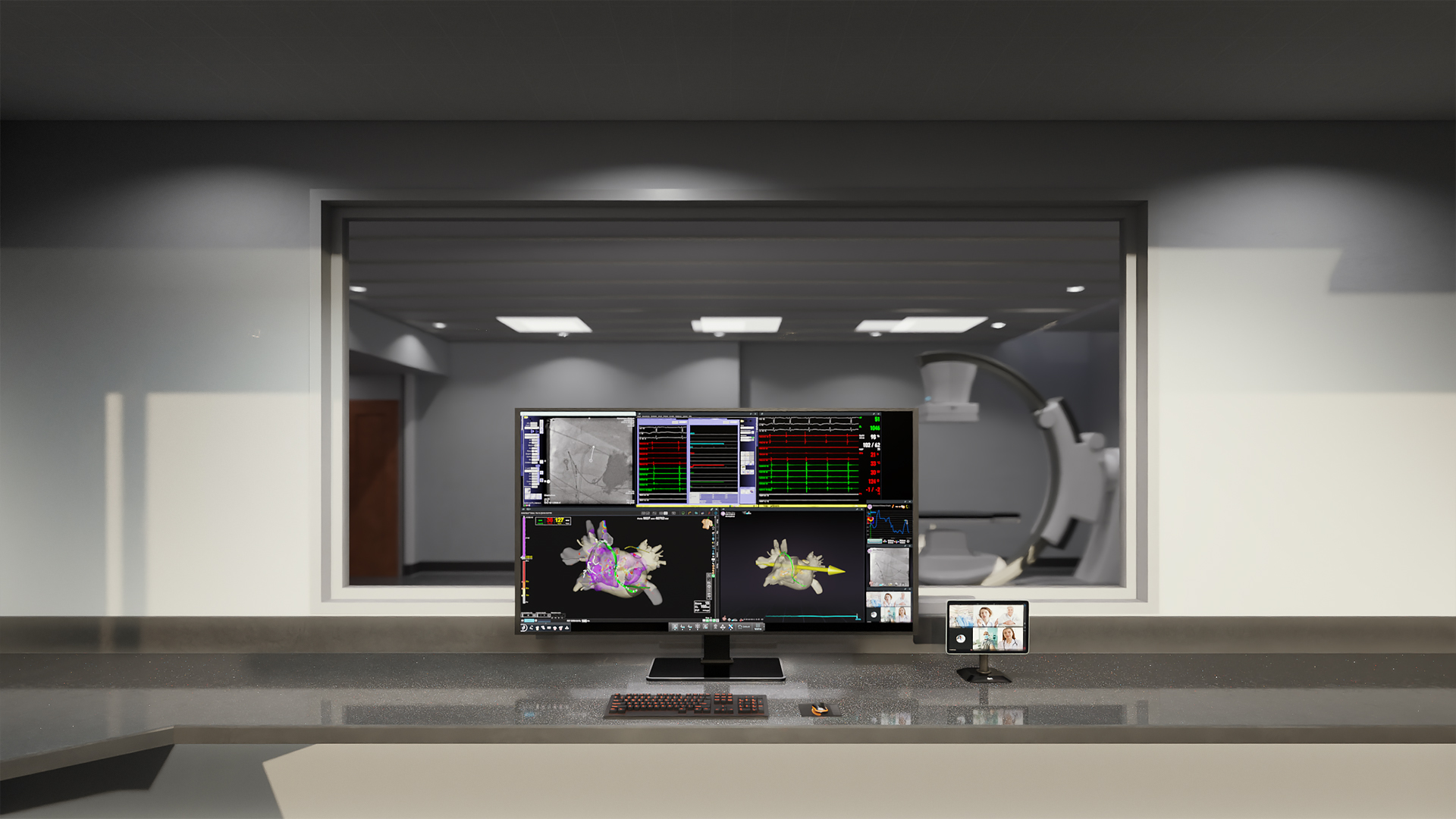 Stereotaxis Announces FDA Clearance and Launch of Synchrony System