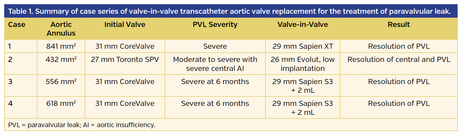 Table 1. Summary of case series of valve-in-valve transcatheter aortic valve replacement for the treatment of paravalvular leak.