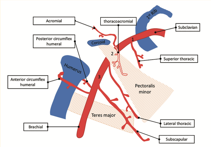 Tai PercAx Impella Figure 22