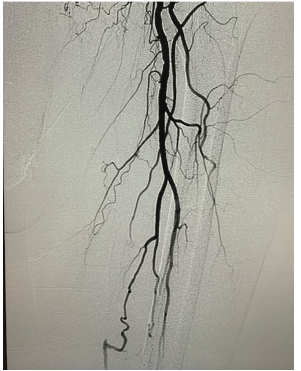 Tai Transcollateral Figure 1