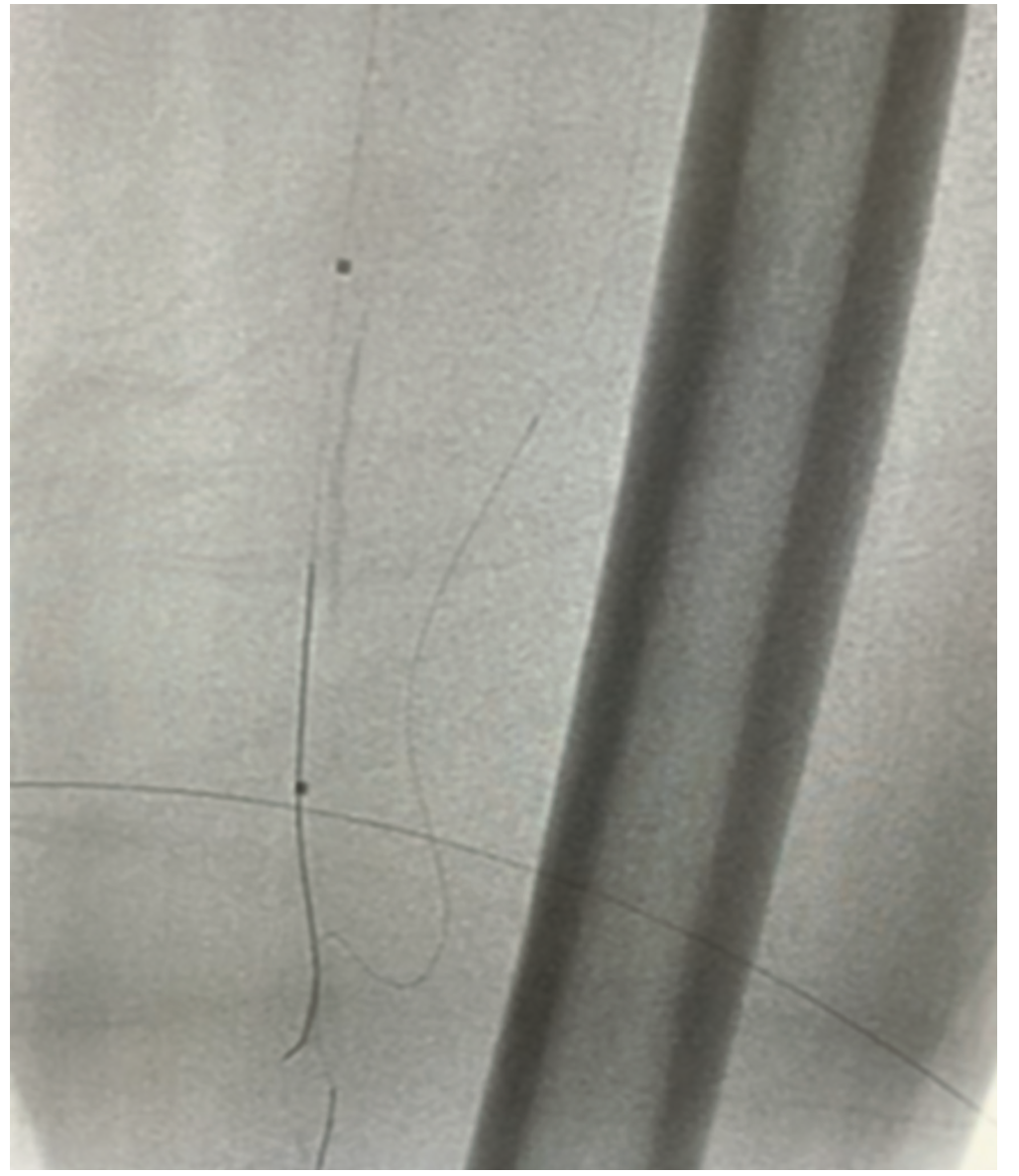 Tai Transcollateral Figure 2