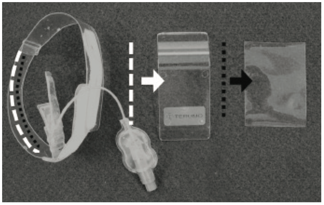 Takahashi PCI Figure 1