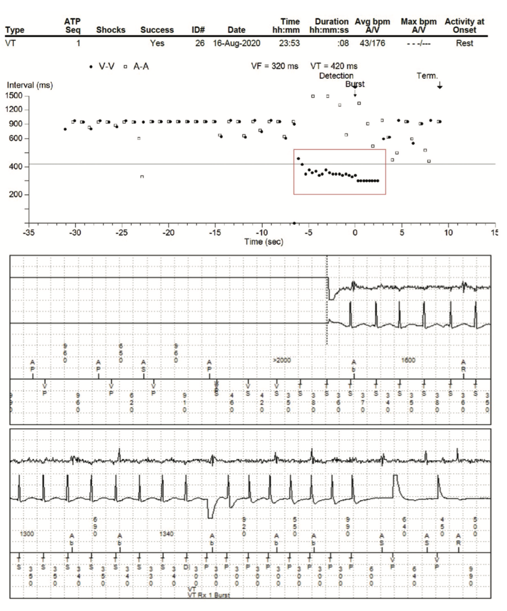 Tale Tetralogy of Fallot Figure 2