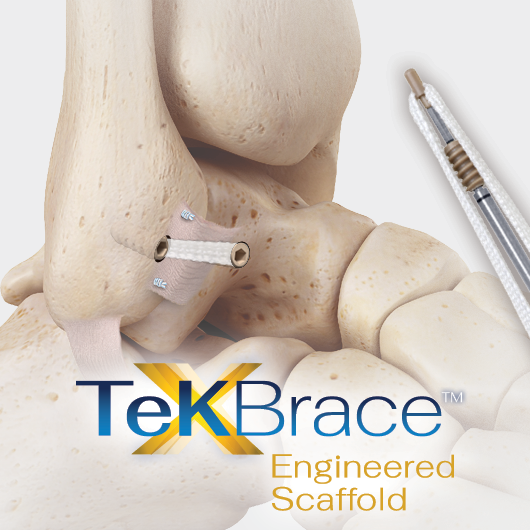 TeKBrace - a new product from TheraMicro discussed at the ACFAS Conference