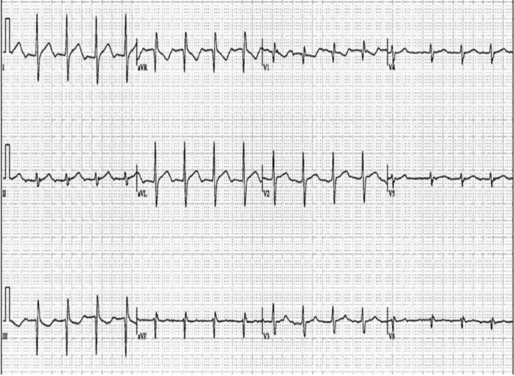 Thihalolipavan Fig Dec 2024 