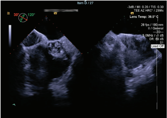 Thihalolipavan Fig 4 Dec 2024 