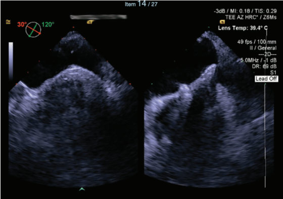 Thihalolipavan Fig 5 Dec 2024 