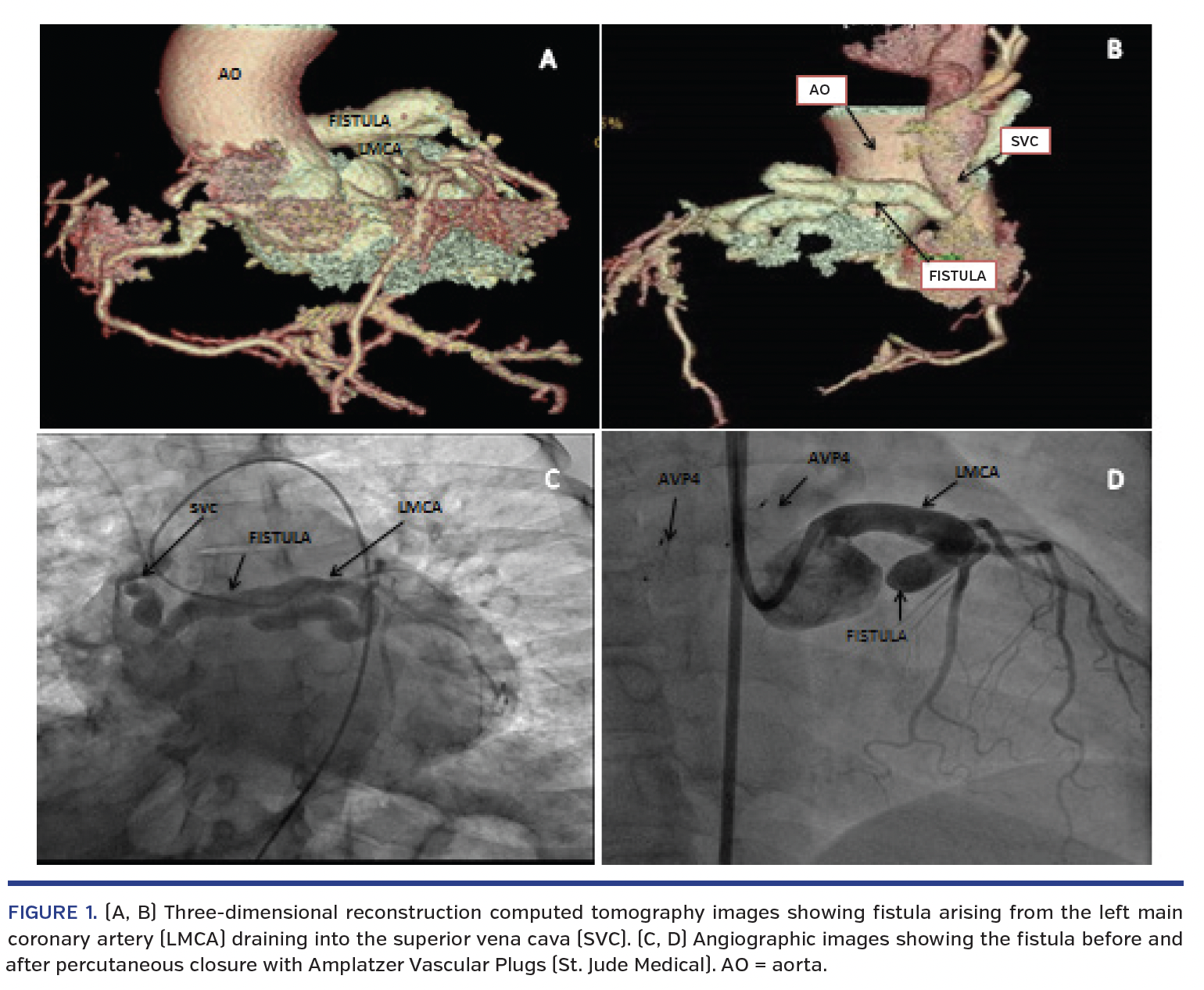 Three-dimensional reconstruction computed tomography