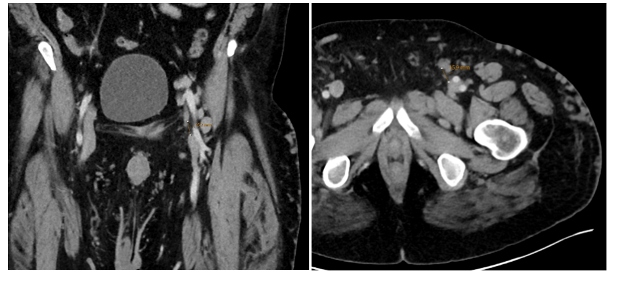Figure 1 and Figure 2