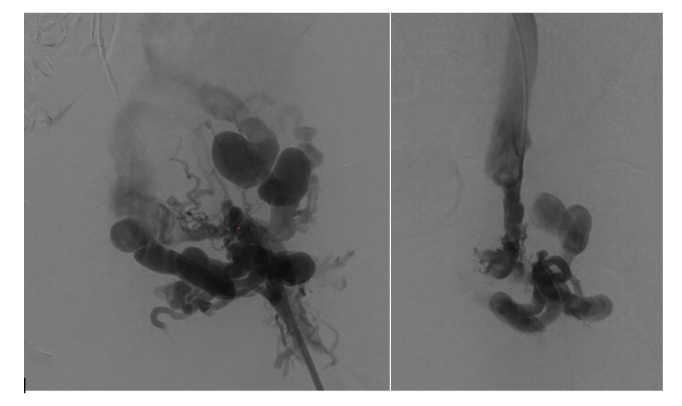 Figure 3 and Figure 4