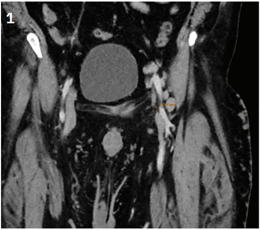 CLD Tiede Figure 1, reprint from VDM