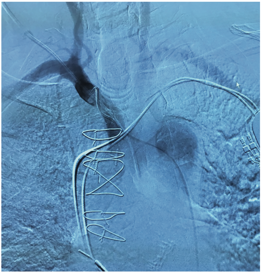 Todarova Hemostasis Figure 1
