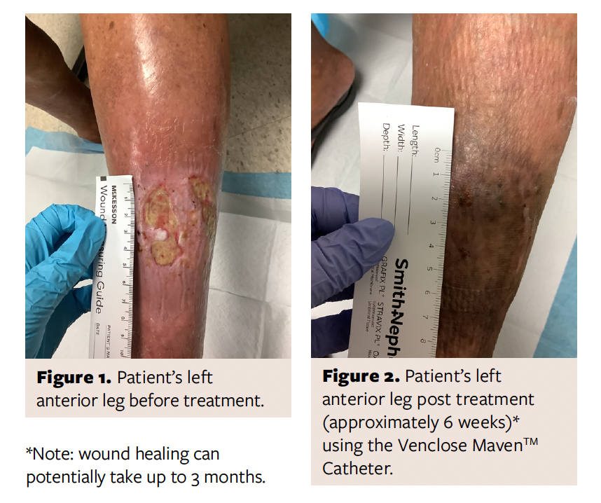 Figure 1 and Figure 2