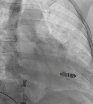 Turitto-Fig3-March2025