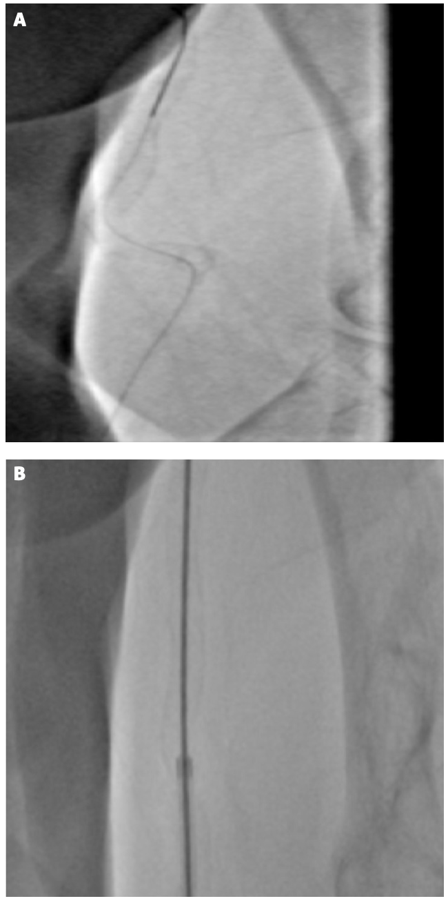 Ungureanu RailTracking Figure 2