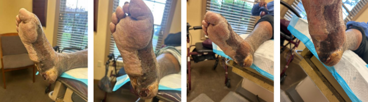 Continued progress throughout several procedures. 