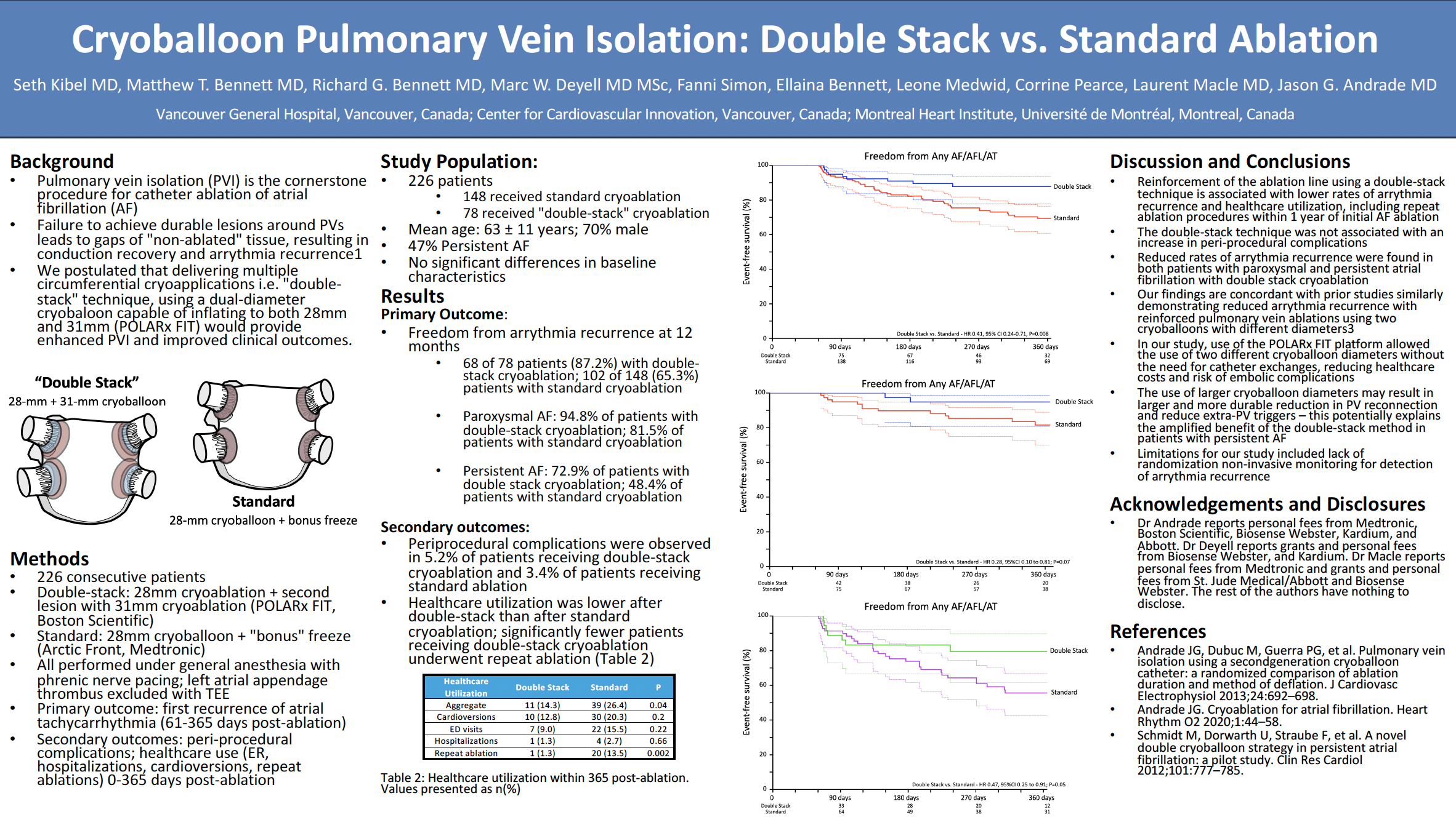 Cryoballoon Pulmonary Vein Isolation: Double Stack vs. Standard Ablation
