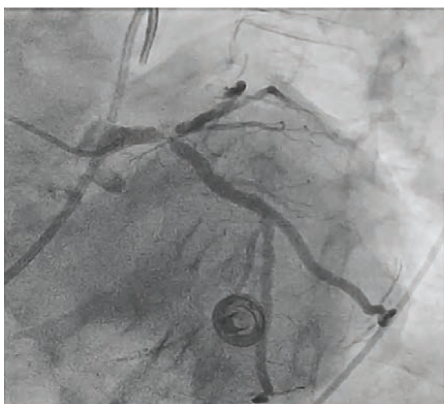 Waksman - Fig 1 - June 2024