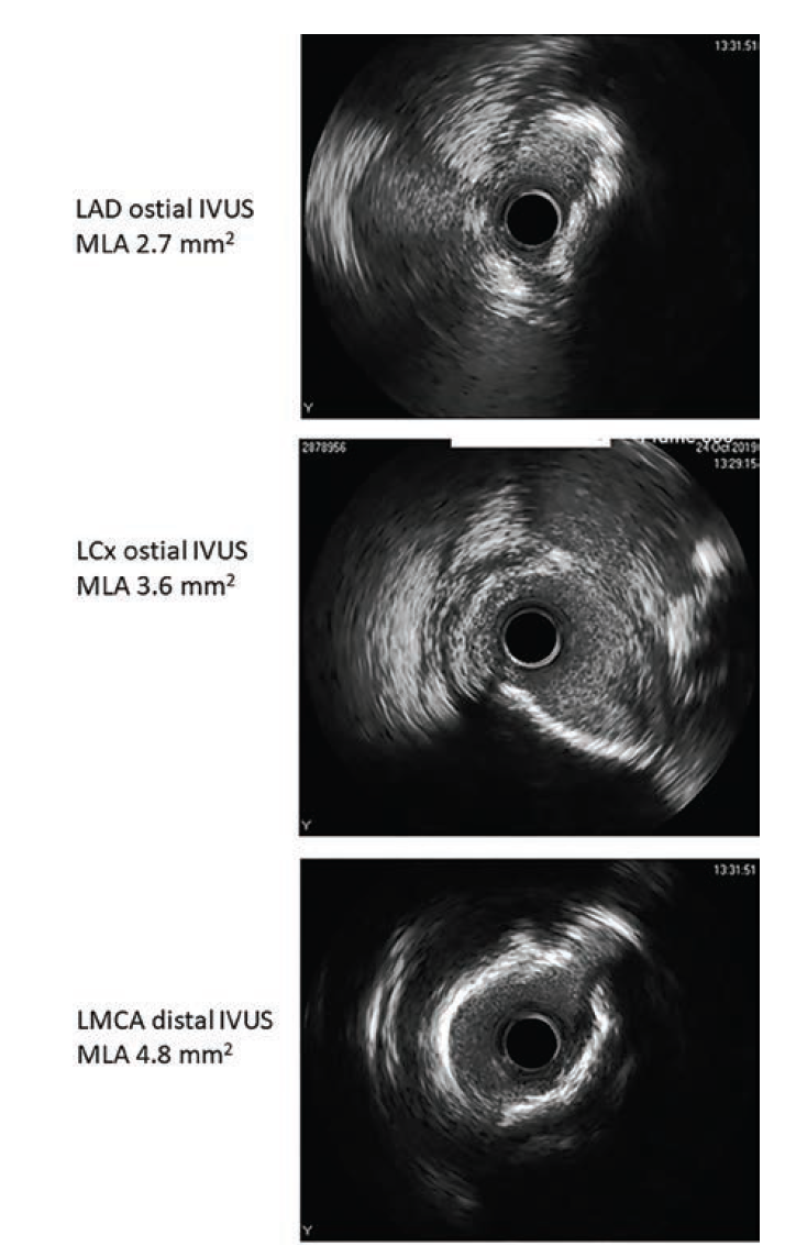 Waksman - Fig 2 - June 2024