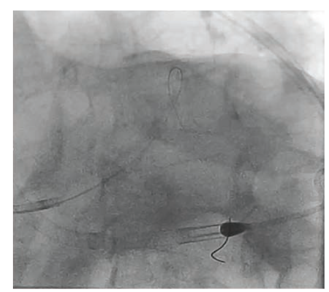 Waksman - Fig 3 - June 2024
