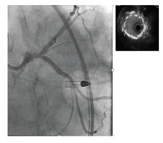Waksman - Fig 5 - June 2024