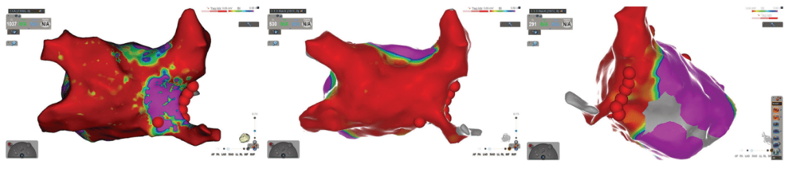 Weerasooriya - Fig 2 - EPLD