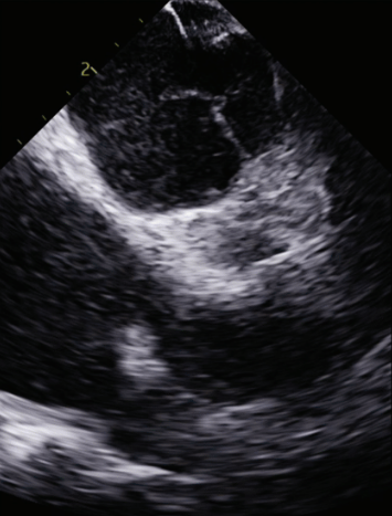 Weisman - Fig 1 - Oct 2024