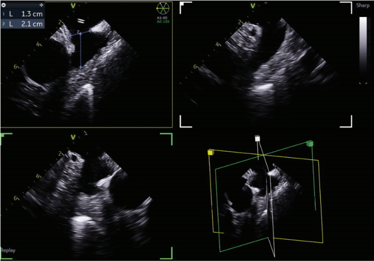 Weisman - Fig 2 - Oct 2024