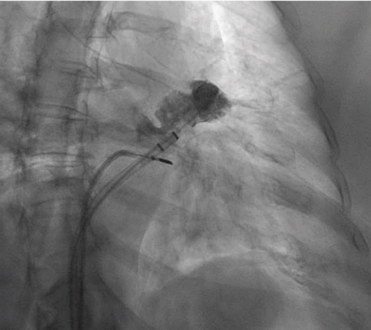 Weisman - Fig 3 - Oct 2024