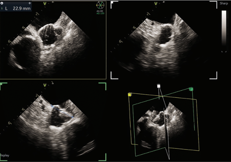 Weisman - Fig 4 - Oct 2024